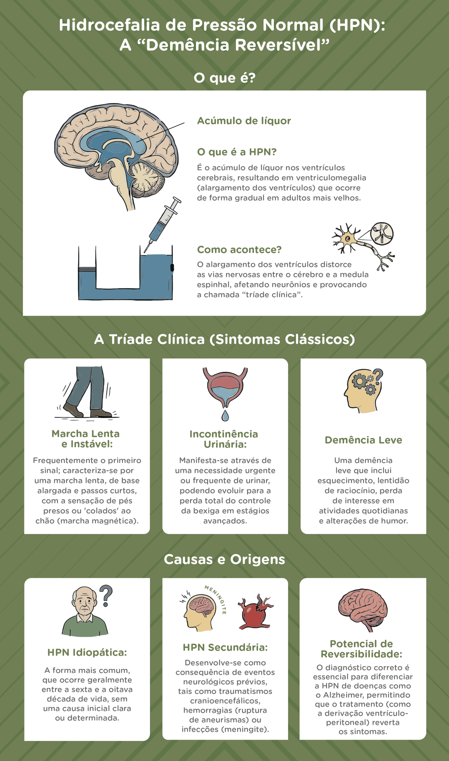 Hidrocefalia-de-pressao-normal-a-demencia-reversivel